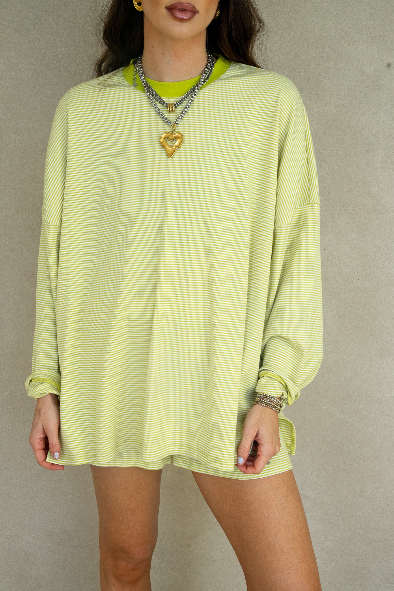 Alex Striped Top- Chartreuse